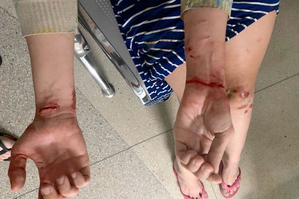 Mulher fica ferida ao tentar defender cãozinho de ataque de Chowchow em Patos de Minas