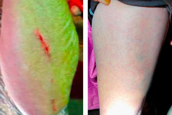 Filha agride a mãe de 65 anos após ser questionada porque estava bebendo cerveja e não se preparando para buscar o filho na escola