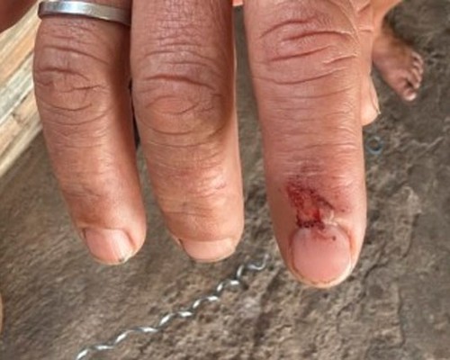 Homem é preso após agredir companheira com pedaço de madeira e tentar fugir da Polícia em Patos de Minas