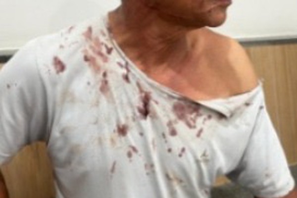 Polícia Civil indicia homem que teria tentado matar taxista durante uma corrida em Patos de Minas