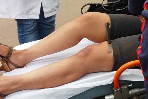 Polícia Civil colhe depoimento de vítima de estupro que ficou com faca cravada na perna