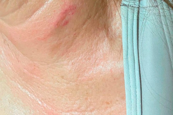 Marido suspeita de traição após esposa começar a frequentar academia e a agride em Patos de Minas