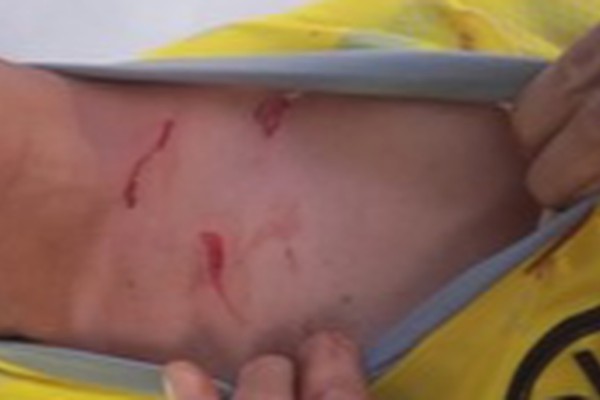 Homem é atacado com tesoura durante briga em barbearia e dois acabam presos em Patos de Minas