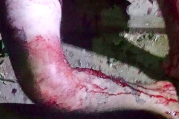 Adolescente atira em desafeto perto de viatura da PM e acaba detido com a arma do crime