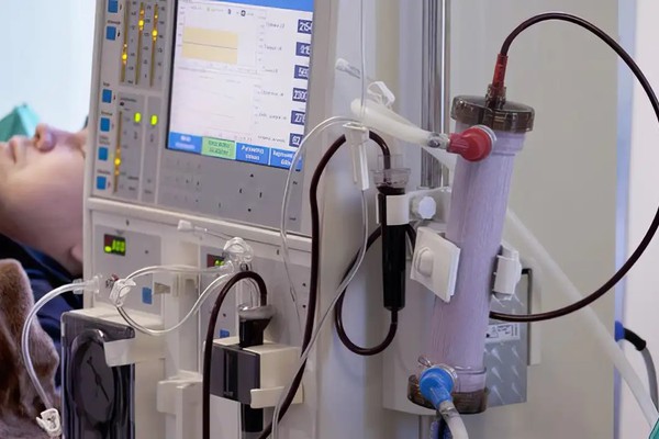 Estudo alerta para subdiagnóstico da doença renal crônica no Brasil
