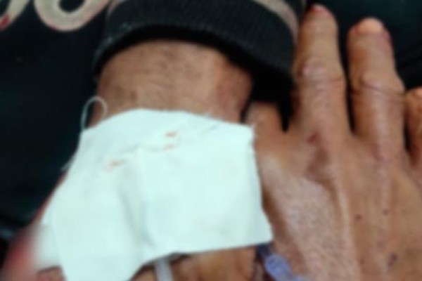Garimpeiro agredido a golpes de facão é socorrido em estado grave em Carmo do Paranaíba