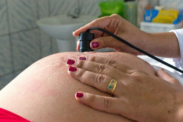 Número de óbitos de grávidas em 2021 já ultrapassa todo ano de 2020