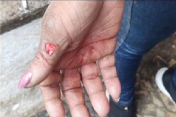 Mulher é agredida por ex-companheiro no banheiro do Mercado Municipal de Patos de Minas