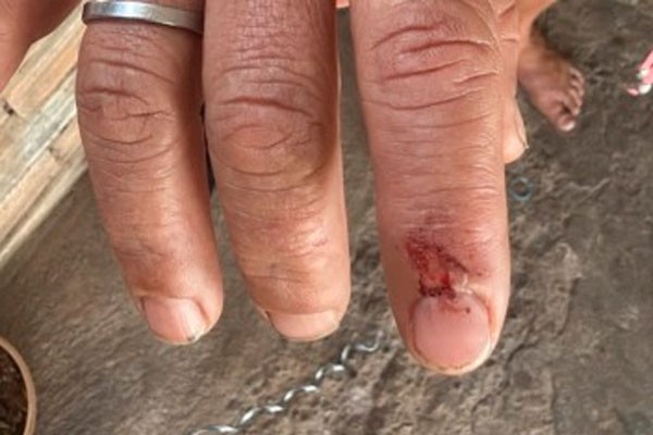 Homem é preso após agredir companheira com pedaço de madeira e tentar fugir da Polícia em Patos de Minas