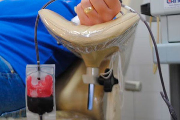 Com queda de 50% nos estoques, Hemocentro convoca doadores de sangue “O” negativo
