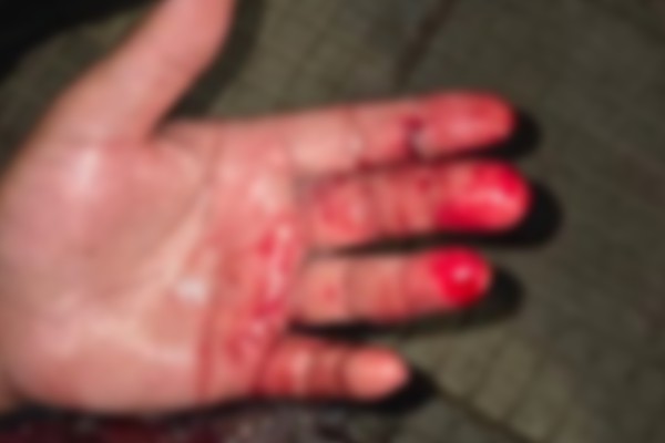Casal é preso após agressões e facada durante briga em casa no Centro de Patos de Minas