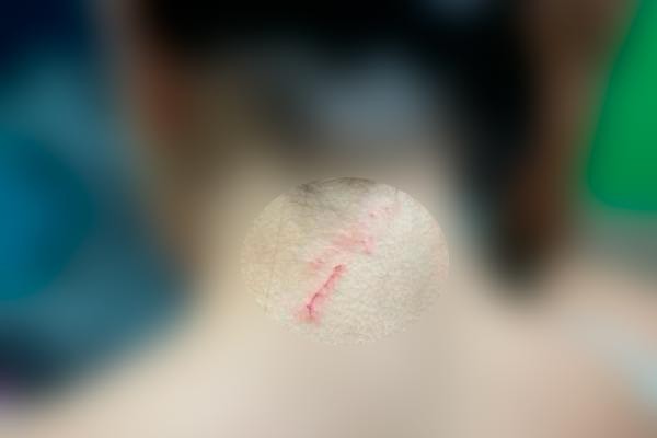 Pai agride filha para “corrigi-la”, mãe intervém e também é agredida em Patos de Minas